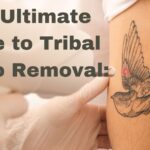 The Ultimate Guide to Tribal Tattoo Removal: