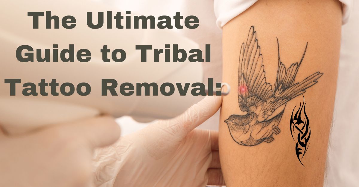The Ultimate Guide to Tribal Tattoo Removal: