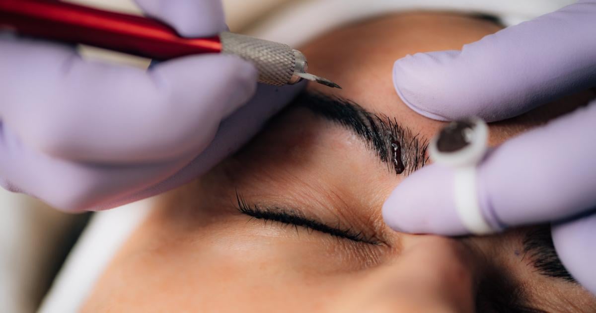 Eyebrow-Tattoo-Removal