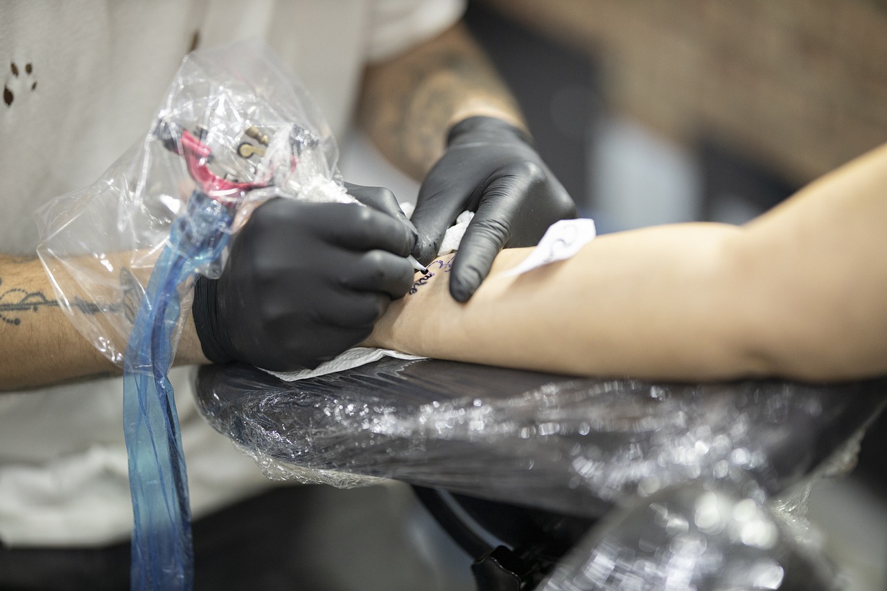 How-Does-Tattoo-Removal-Work