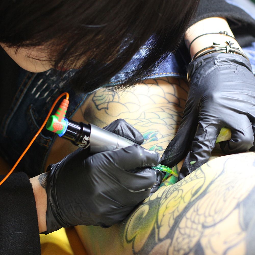 How-Does-Tattoo-Removal-Work