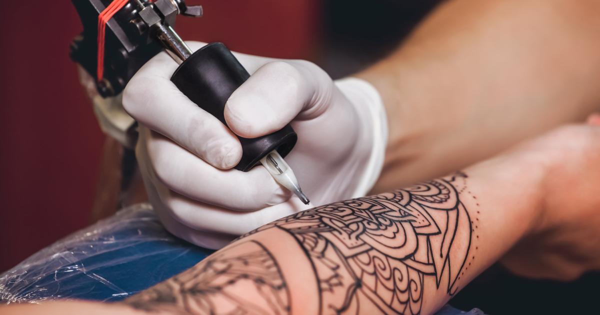 How-Does-Tattoo-Removal-Work