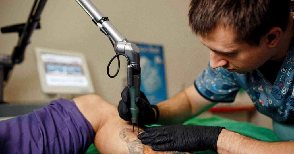 How-Much-Does-Tattoo-Removal-Cost