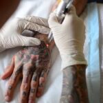 How-Much-Is-Tattoo-Removal-REALLY-Cost