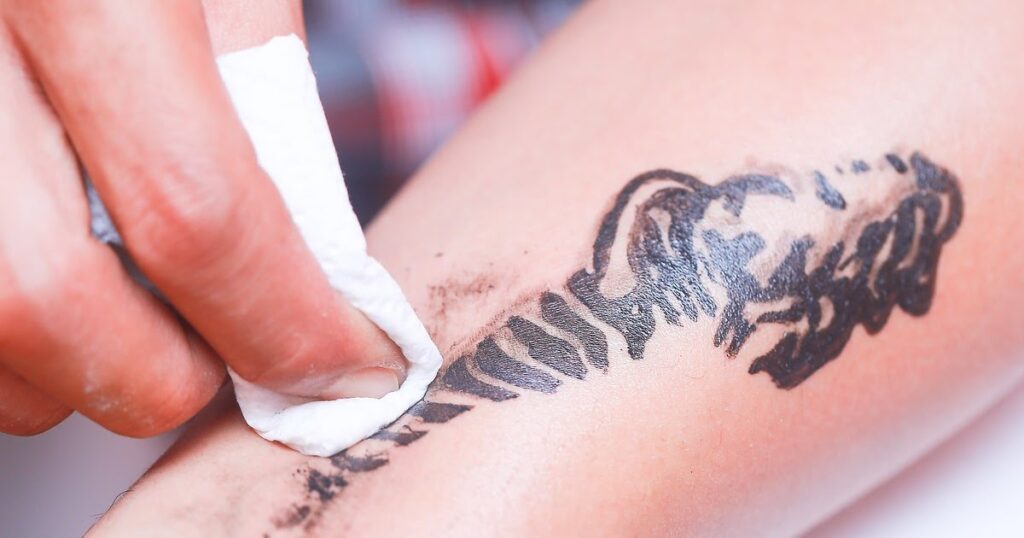 How-to-Remove-a-Temporary-Tattoo