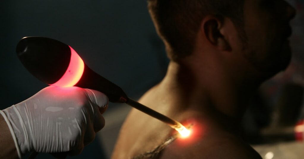 Laser-Tattoo-Removal-Cost