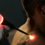 Laser-Tattoo-Removal-Cost