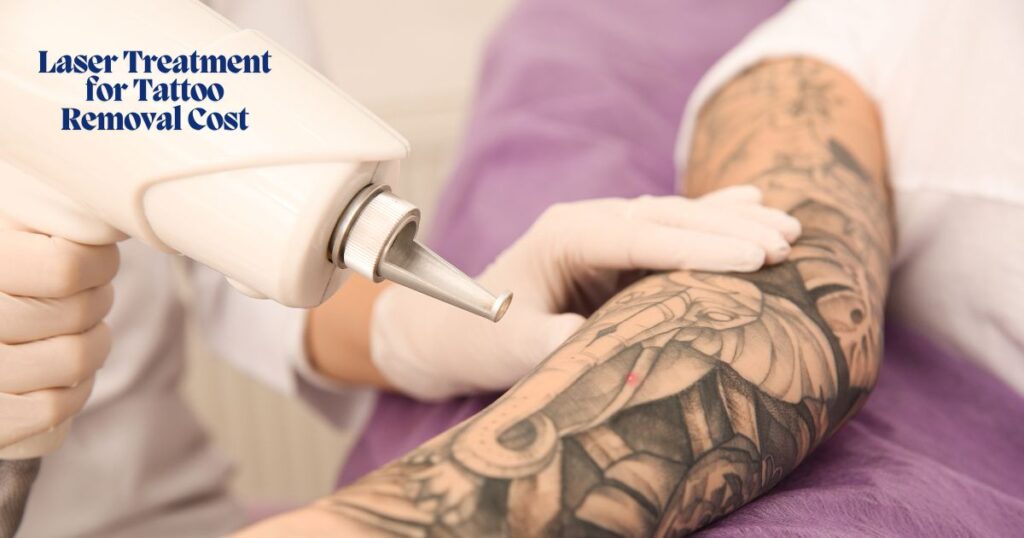 Laser-Treatment-for-Tattoo-Removal-Cost