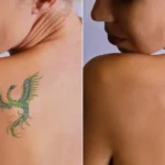 Tattoo-Cover-Ups-Generally-Cost-Less-Than-Multiple-Laser-Removal-Sessions