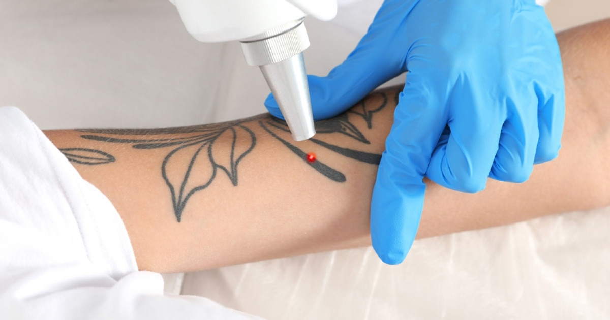 Tattoo-Cover-Ups-Generally-Cost-Less-Than-Multiple-Laser-Removal-Sessions